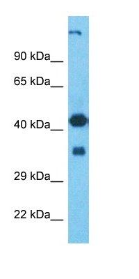 GNT2C antibody