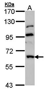 GnT-III antibody