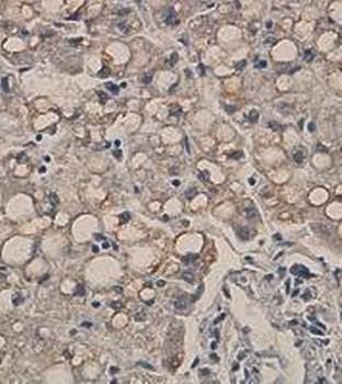 GnT-V Rabbit Polyclonal Antibody