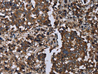 GOLGA2 Antibody