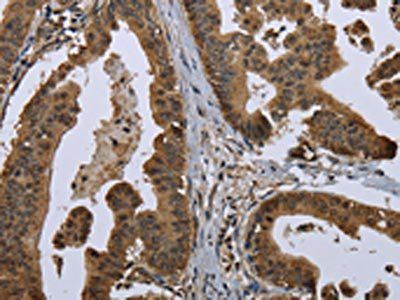 GOLGA2 Antibody