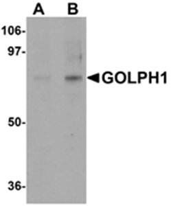 GOLPH1 Antibody