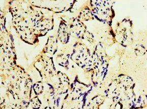 GOSR1 Antibody
