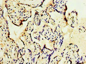 GOSR1 antibody