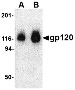 gp120 Antibody