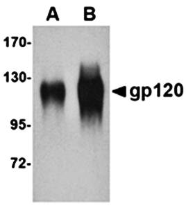 gp120 Antibody