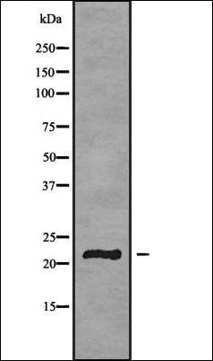 GP1BB antibody