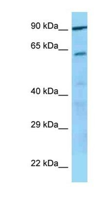 GP5 antibody