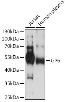 GP6 antibody
