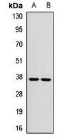 GP9 antibody