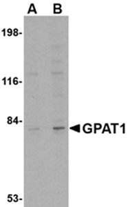 GPAT1 Antibody