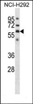 GPC3 antibody