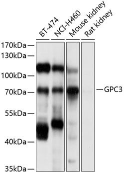 GPC3 antibody
