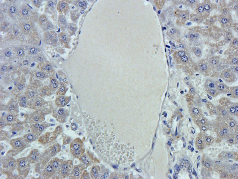 GPC3 Rabbit Polyclonal Antibody