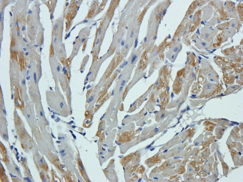 GPC3 Rabbit Polyclonal Antibody