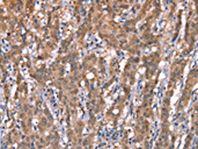 GPC6 Antibody