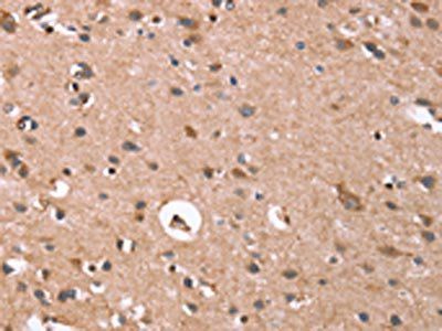 GPC6 Antibody