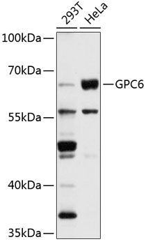 GPC6 antibody