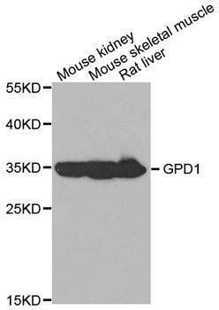 GPD1 antibody