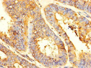 GPD2 Antibody