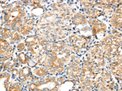 GPD2 antibody