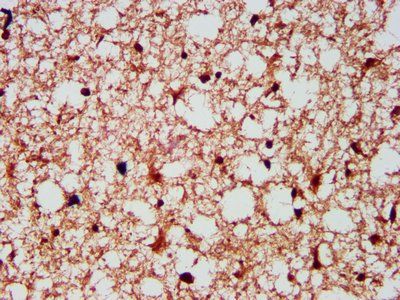 GPHN Antibody