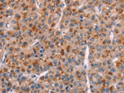 GPHN Antibody