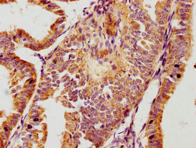 GPLD1 antibody