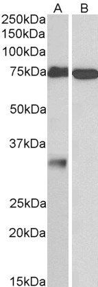 Goat anti-GPM6A Antibody