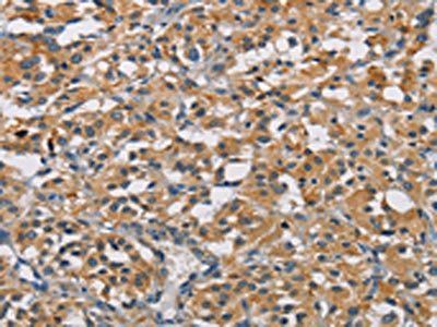 GPM6A Antibody