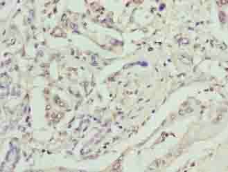 GPM6B antibody