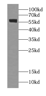 GPR101-Specific antibody