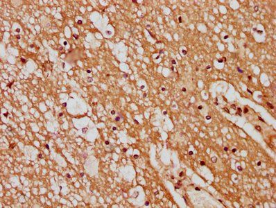 GPR107 Antibody