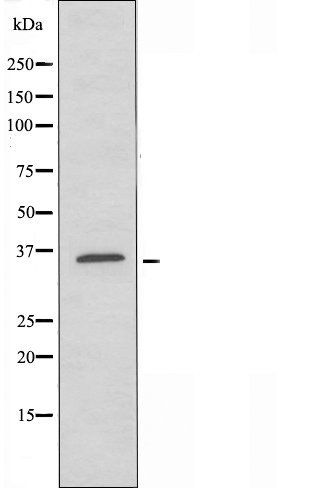 GPR119 antibody