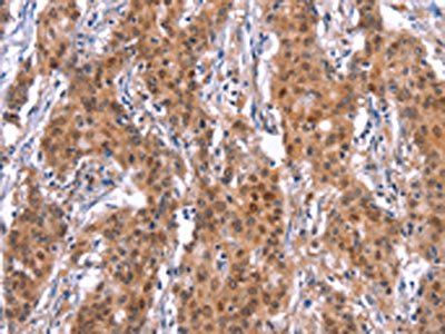 GPR124 Antibody