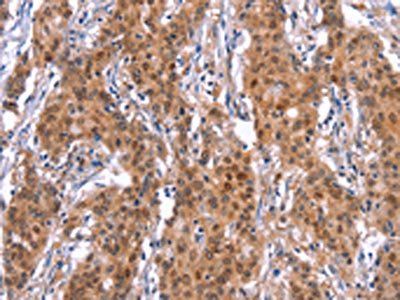 GPR124 antibody