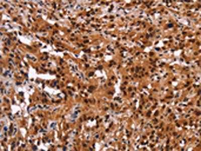 GPR124 Antibody