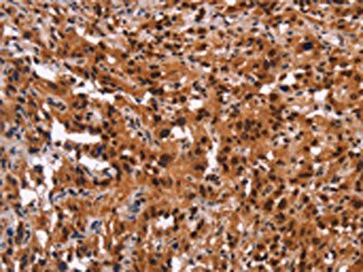 GPR124 antibody