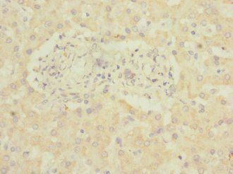 ADGRG6 Antibody