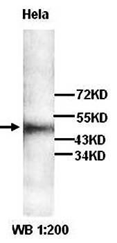 GPR143 Rabbit Polyclonal Antibody
