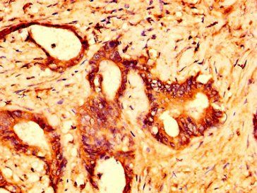 GPR158 Antibody
