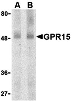 GPR15 Antibody