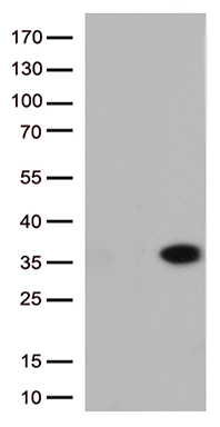 GPR17 antibody