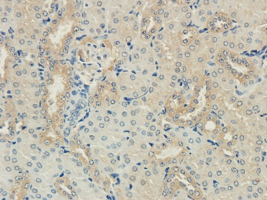 GPR17 antibody