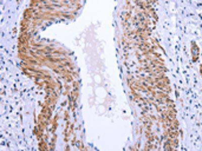 GPR171 Antibody