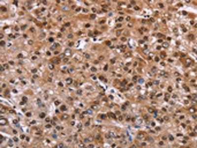 GPR171 Antibody