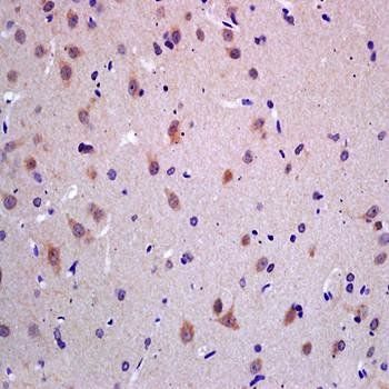 GPR172B Rabbit Polyclonal Antibody