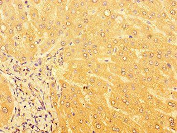 GPR179 Antibody