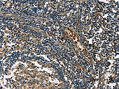 GPR182 Antibody