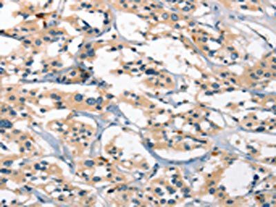 GPR182 Antibody
